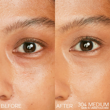 Shiseido Synchro Skin Radiant Lifting Concealer (N°304 Medium) 2.7g | apothecary.rs