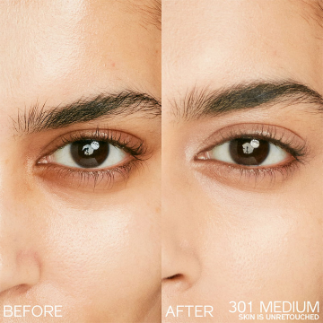 Shiseido Synchro Skin Radiant Lifting Concealer (N°301 Medium) 2.7g | apothecary.rs